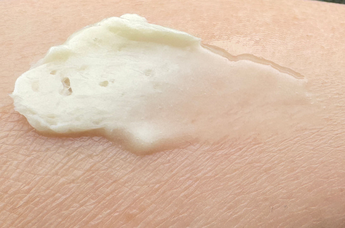 Calendula infused body butter applied to a persons skin